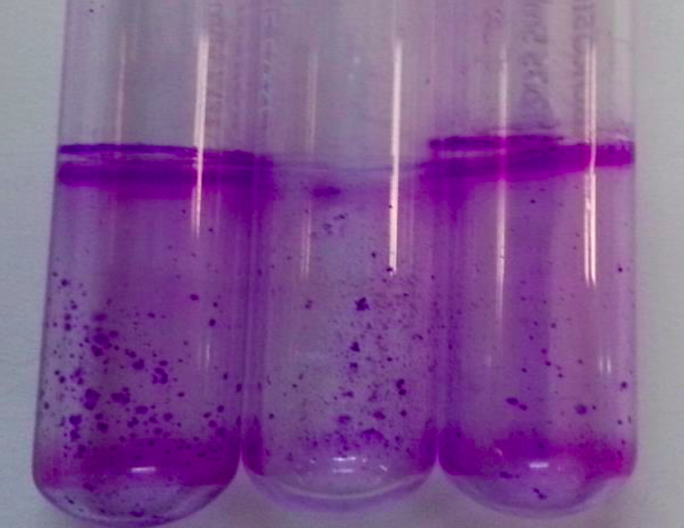 Tubes showing strong biofilm production
